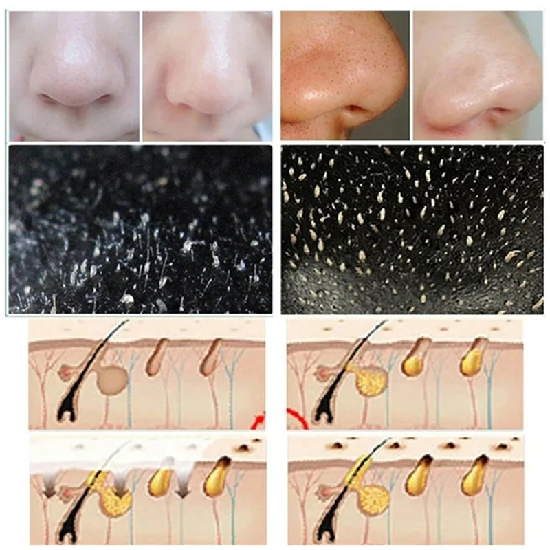 10pcs Blackhead Nose Strips De - Cleanser Face ulasan dan harga