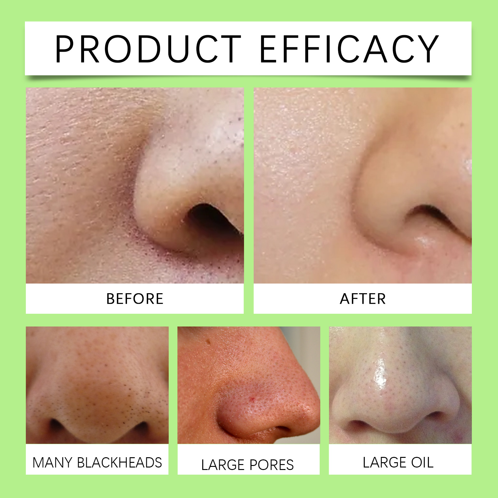 Bamboo Charcoal Nose Strips fo - Cleanser Face ulasan dan harga