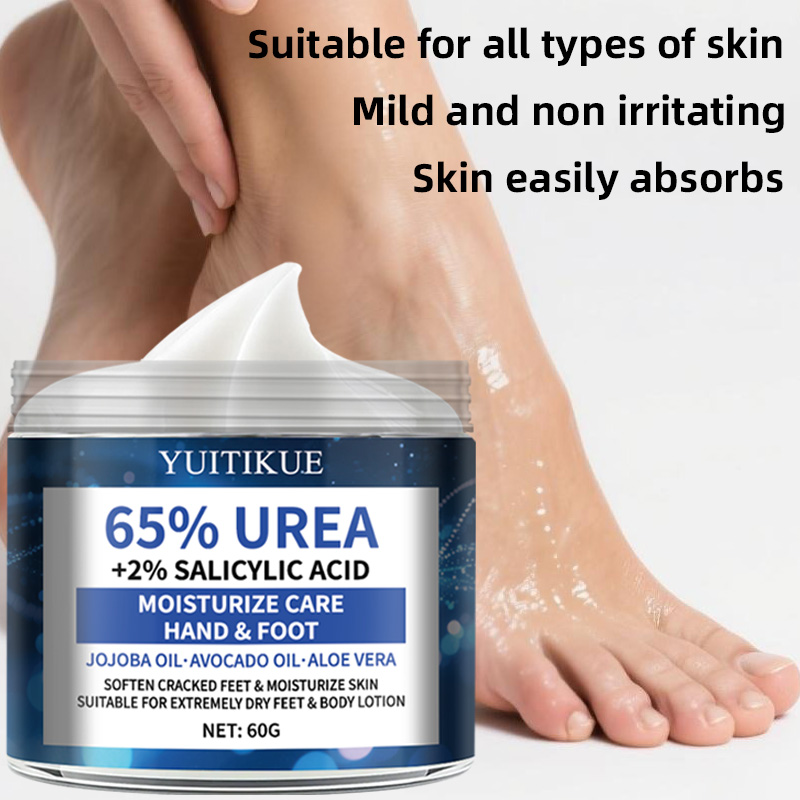 YUITIKUE 65% Urea Foot Cream 6 - Urea Foot Cream ulasan dan harga